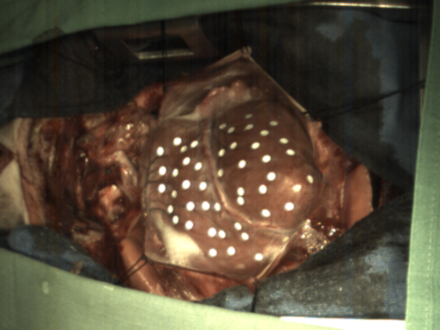 Schweineherz mit Markern